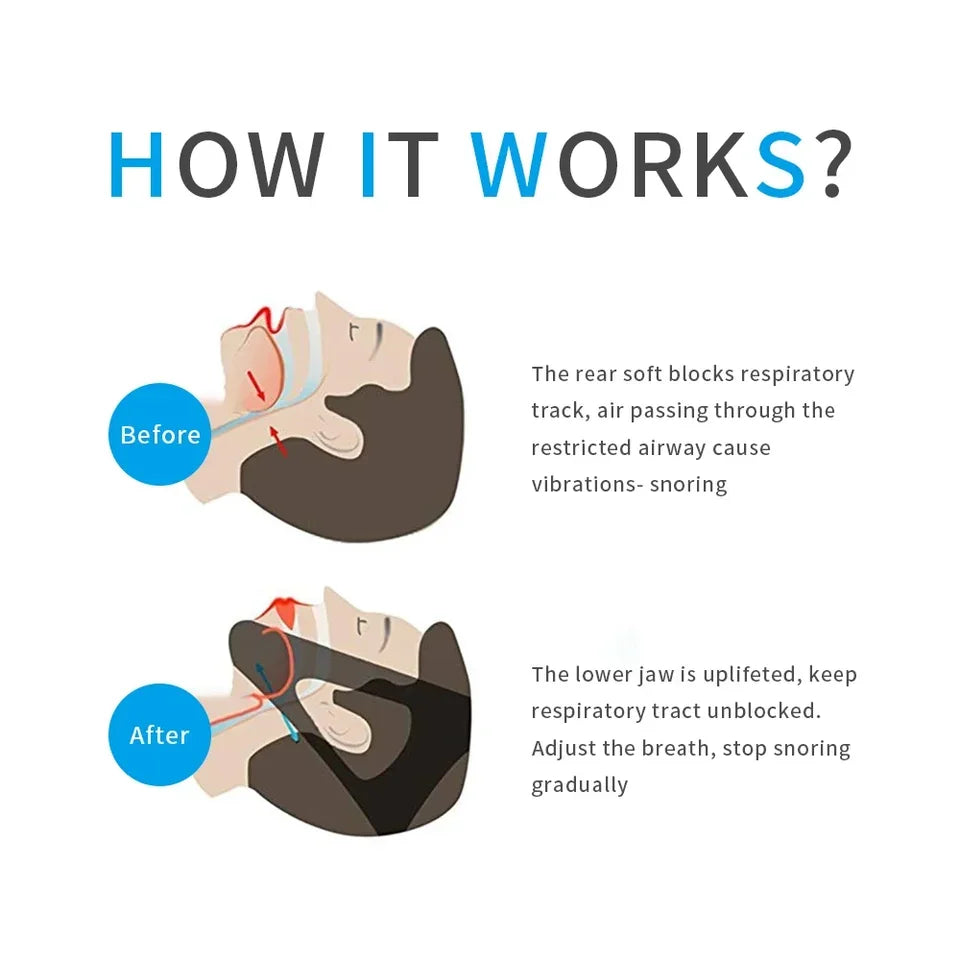 Anti-Snore Chin Strap – Adjustable Sleep Support for Quieter Nights